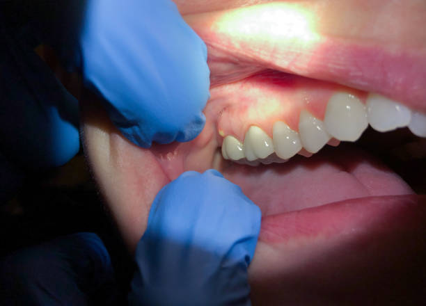 Best Emergency Dental Care for Sports Injuries in Liberty, UT