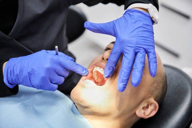 Best Emergency Wisdom Tooth Extraction in Liberty, UT